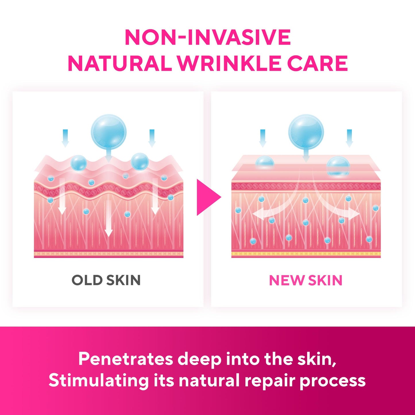 Silicone Face Patches-Forehead Wrinkle Patches, Reusable Under Eye and Smile Line Patches 5pcs