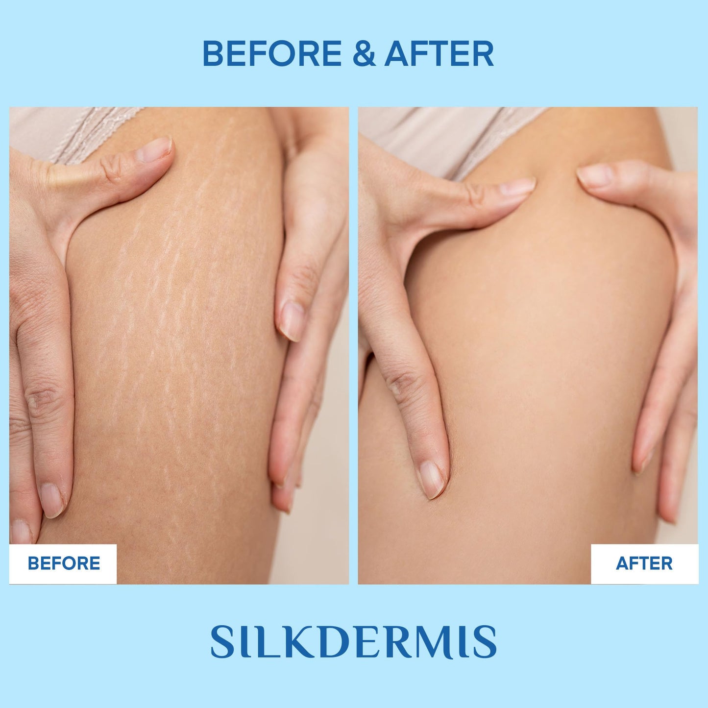 Skin Toning and Firming Gel: Skin Tightening Cream for Body - Effective Cellulite Cream for Tighs Buttocks & Stomach (6.7 Ounce (Pack of 1))