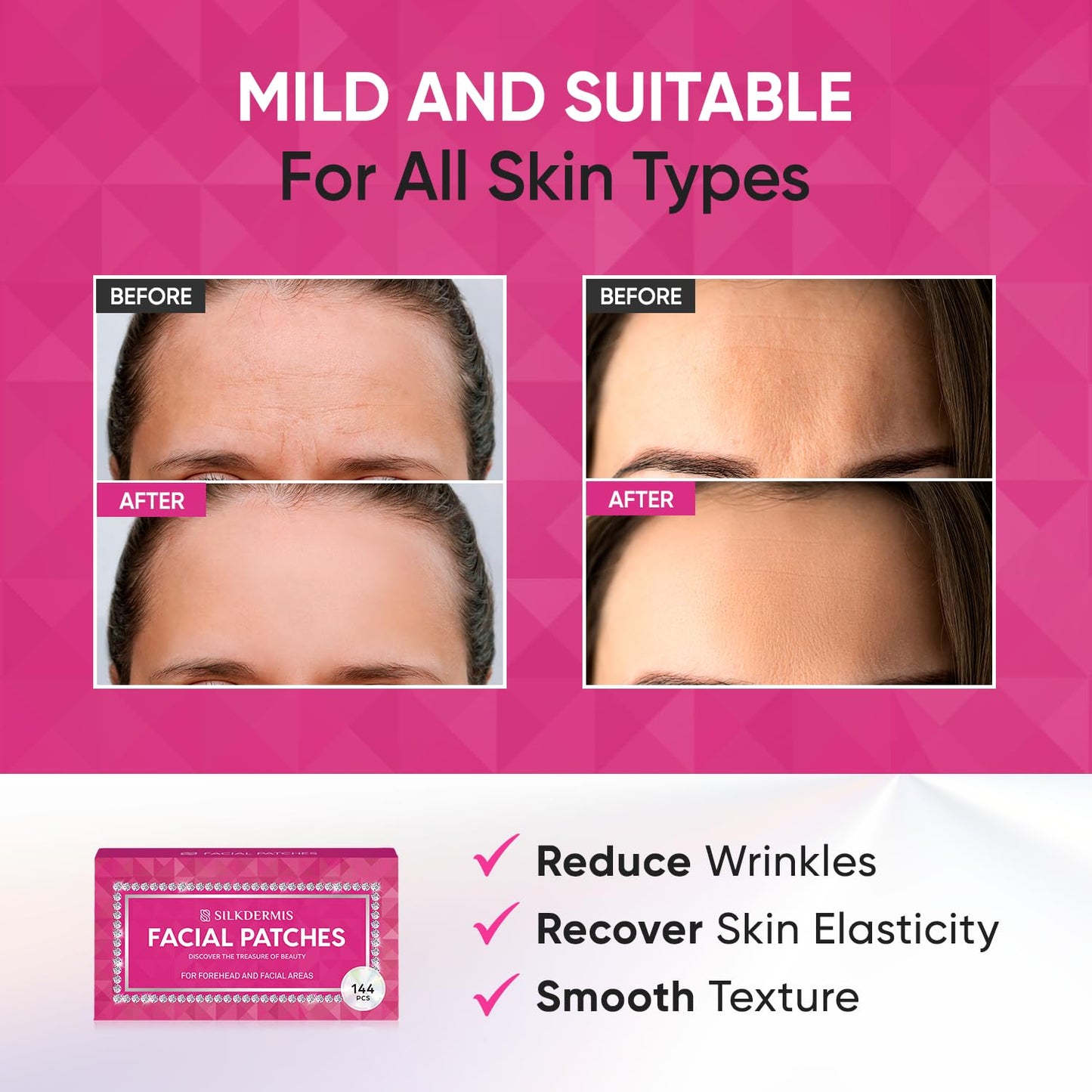 Anti Forehead Wrinkle Patches: Anti Wrinkle Facial Patches overnight- Forehead Wrinkles Treatment 144 pcs