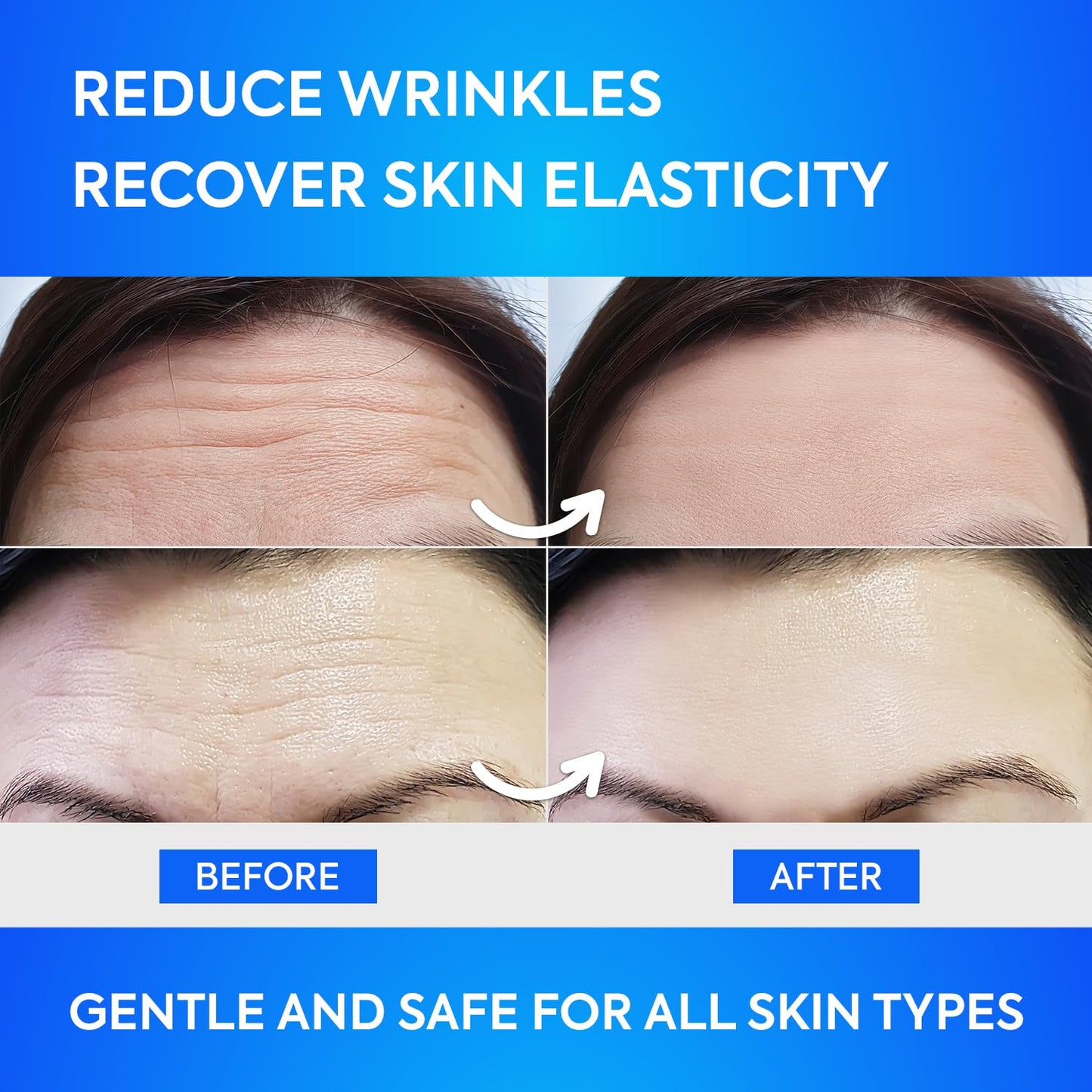 Forehead Wrinkle Patches 12Pcs with Aloe, Collagen, Vitamin E, Anti Wrinkle Patches, Forehead Wrinkles Treatment
